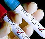  167 новых случаев заражения ВИЧ-инфекцией зарегистрировано в Астраханской области