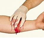 Пьяный астраханец порезал артерию, перелезая через забор, и умер