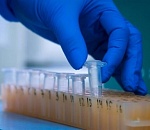 В Астрахани стремительно растёт число заразившихся коронавирусом