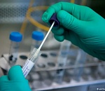 Еще 32 астраханца взяты под наблюдение из-за коронавируса