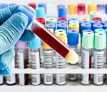 Опыт Астраханской области по выявлению онкозаболеваний будет распространен по всей стране