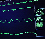 Астраханские полицейские оказали помощь водителю, которому стало плохо с сердцем на дороге