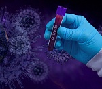 Еще 171 астраханец заразился коронавирусом