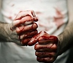 Астраханка, избитая приятелем, умерла в больнице спустя полтора месяца