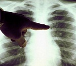 Снова странная арифметика от астраханского минздрава: общее число больных ковидом меньше, чем заболело за сутки