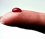 Астраханцам предлагают бесплатно пройти диагностику свертываемости крови 